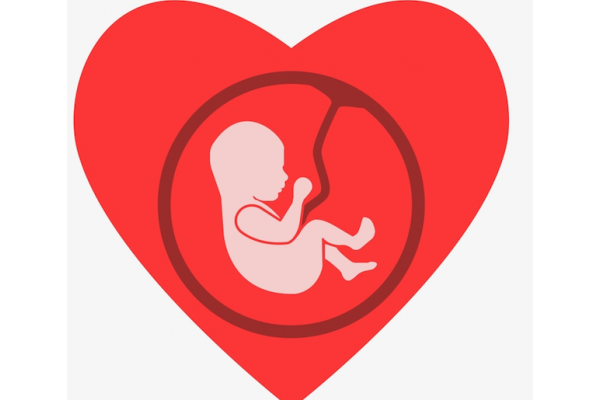 Corte Suprema respalda ley de Kentucky para que madres vean ultrasonido antes de decidir abortar