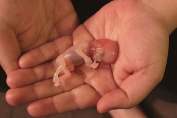 Una iniciativa busca que el aborto en California sea clasificado como asesinato en primer grado Una iniciativa busca que el aborto en California sea clasificado como asesinato en primer grado