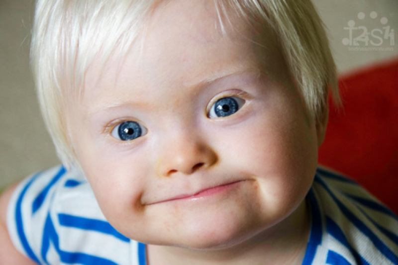 sindrome_de_down.jpg sindrome_de_down.jpg